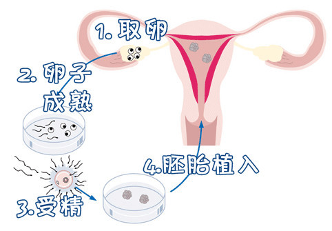 专家